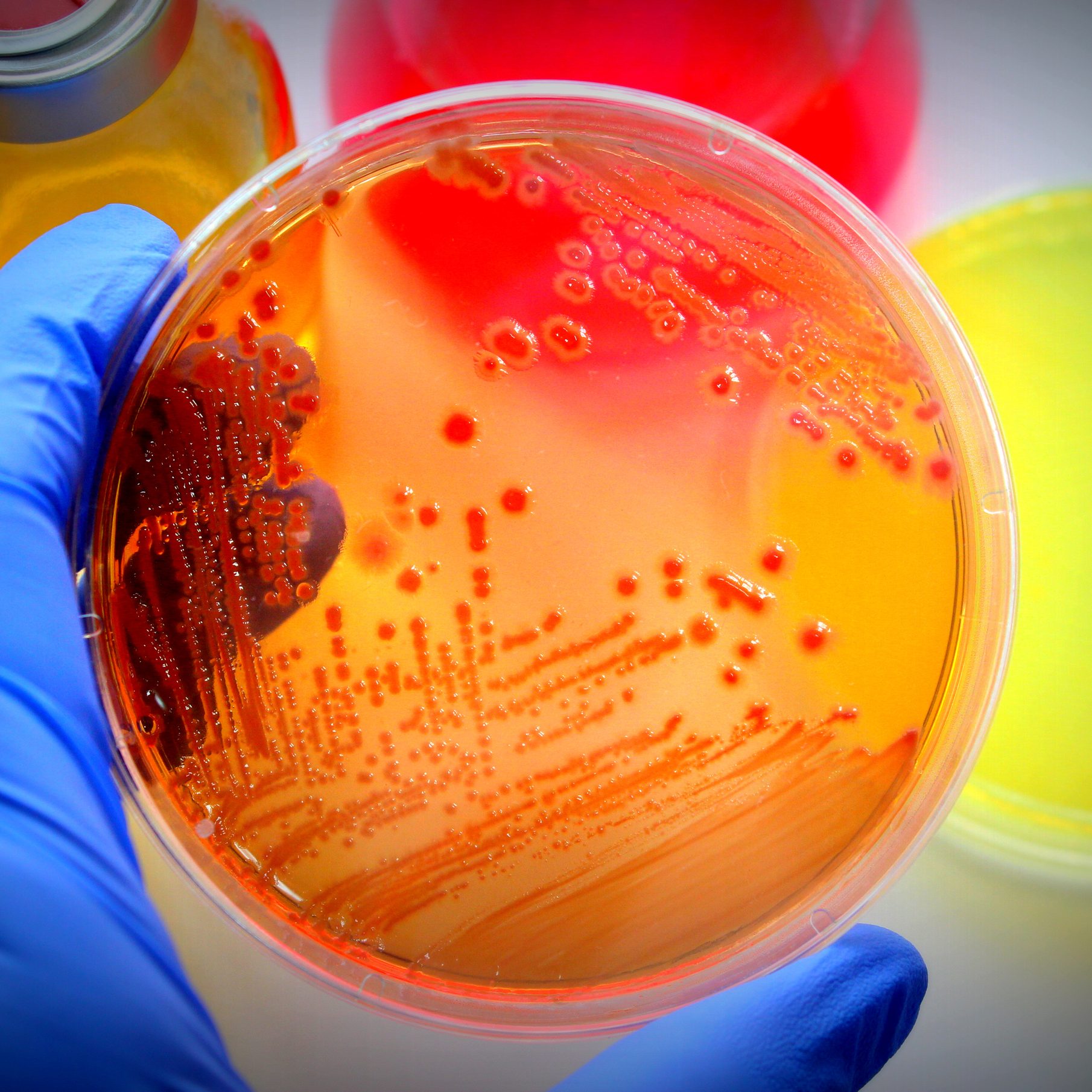 Microbiological examination.